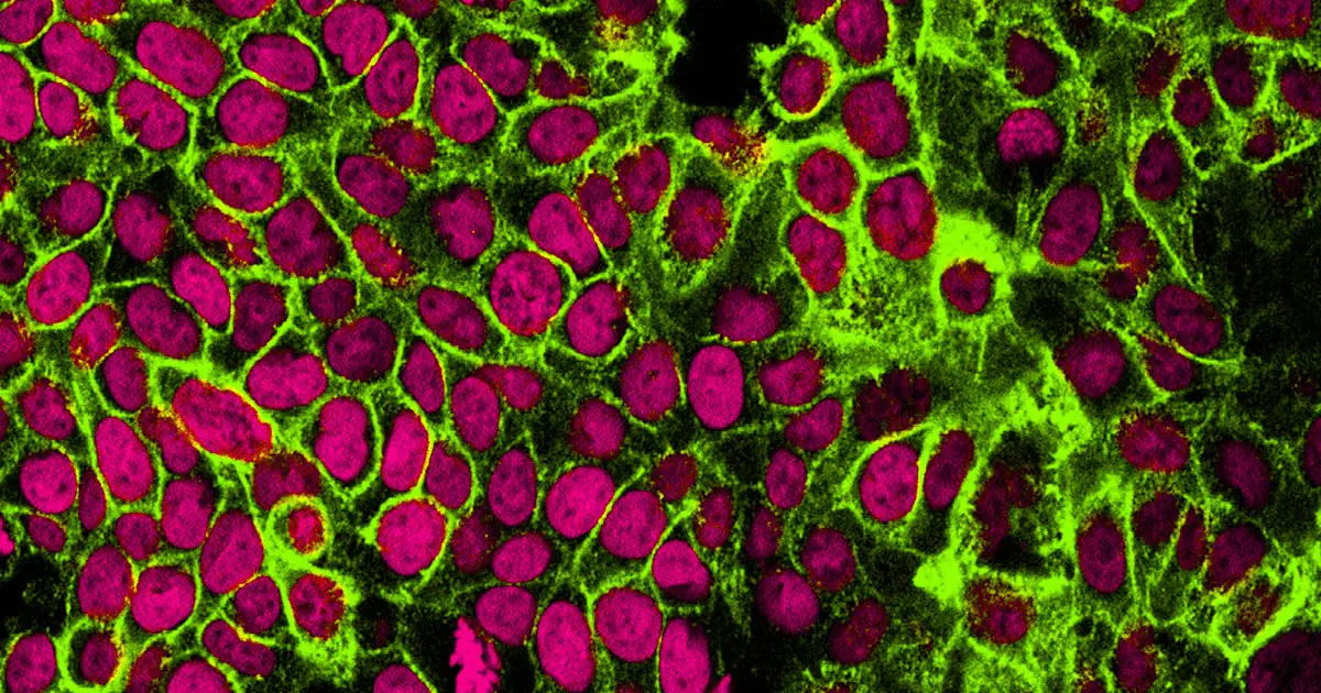 Cura para o câncer: cientistas prometem tratamento em 1 ano Cura para o câncer