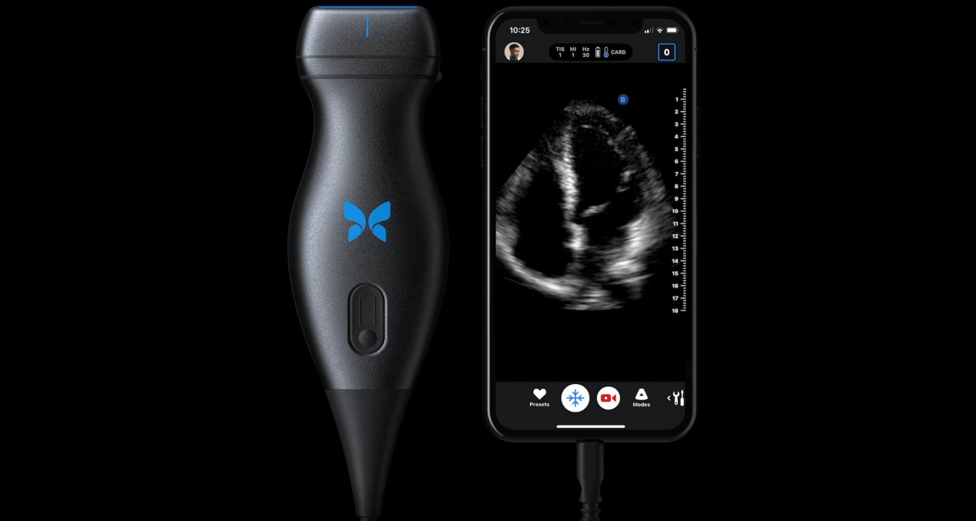 Butterflyiq