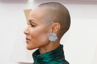 Saiba o que é alopecia, a doença de jada pinkett-smith