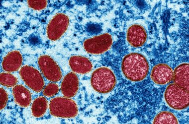 Prefeitura do rj confirma primeiro caso da varíola dos macacos