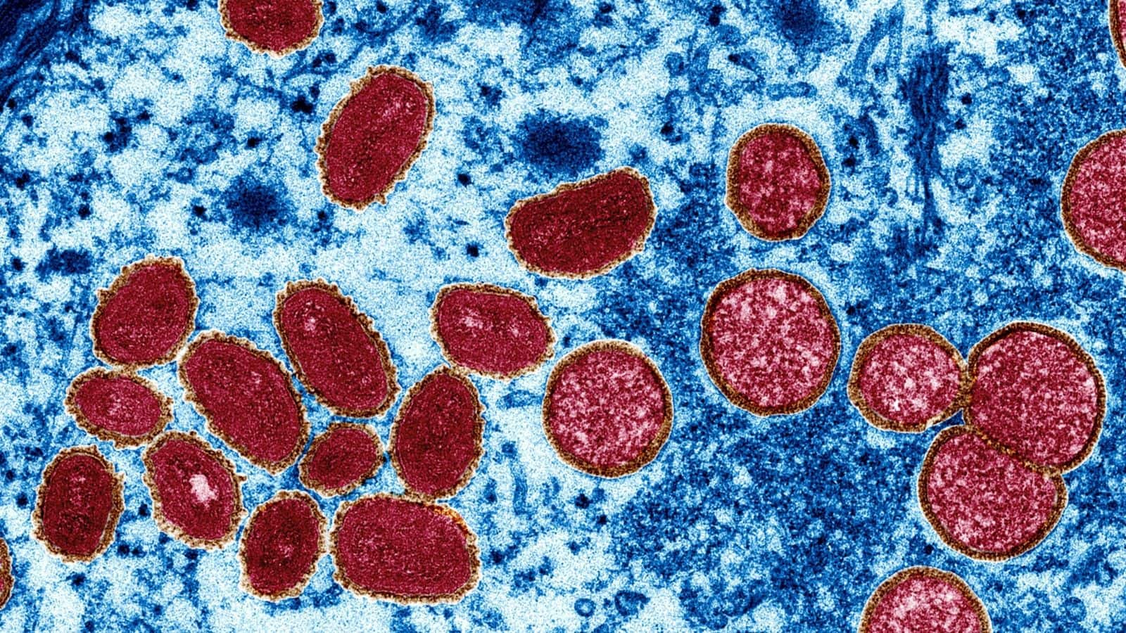 Prefeitura do rj confirma primeiro caso da varíola dos macacos