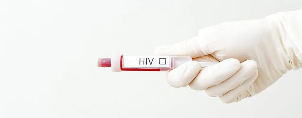 Testes de hiv agora são mais positivos entre heterossexuais Testes de hiv que detectam infecção de hiv e aids