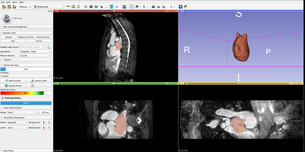 Nvidia amplia projeto de ia monai para facilitar a pesquisa em saúde Médicos fazendo uso do nvidia monai para diagnósticos por imagem