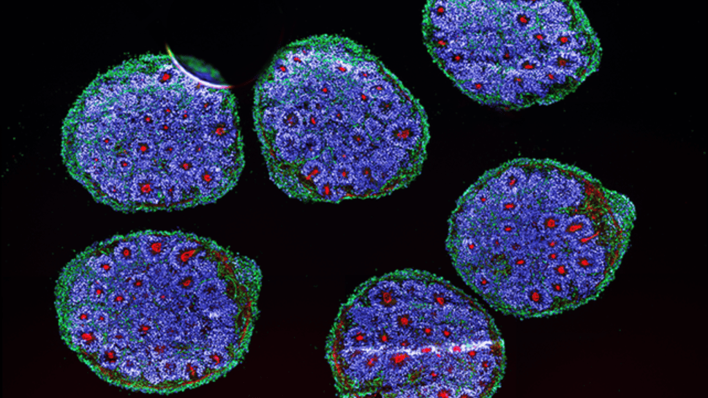 Cyborgcomputer die AI en menselijke hersencellen combineert, werkt echt Cyborg-computer die AI en menselijke hersencellen combineert, werkt echt. Technologie gecreëerd door wetenschappers zou het begin kunnen markeren van een nieuw tijdperk in machinaal leren