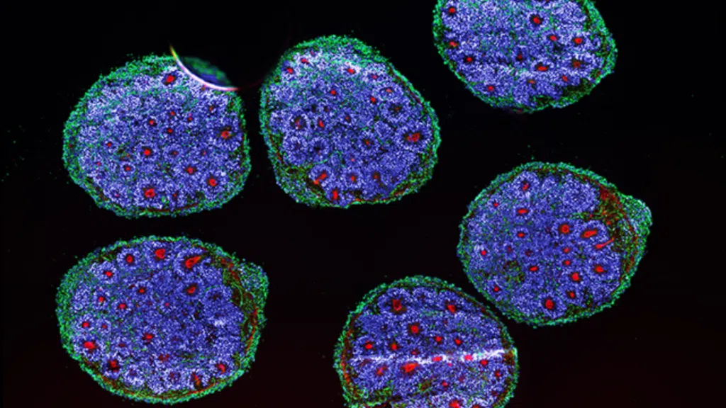 Cyborgcomputer die AI en menselijke hersencellen combineert, werkt echt Cyborg-computer die AI en menselijke hersencellen combineert, werkt echt. Technologie gecreëerd door wetenschappers zou het begin kunnen markeren van een nieuw tijdperk in machinaal leren