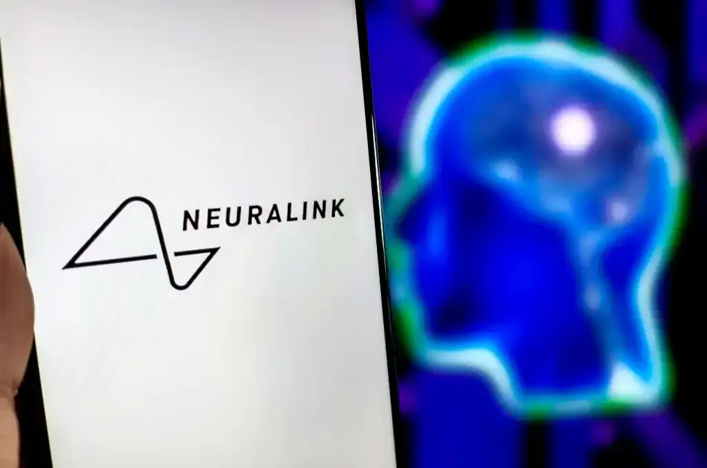 Man die een neuralink-chip heeft gekregen, speelt beschaving met behulp van hersencommando's; horloge Man die een neuralink-chip heeft gekregen, speelt beschaving met behulp van hersencommando's; horloge. Noland Arbaugh, een 29-jarige man met verlamming, kan de muiscursor alleen met zijn hersenen bewegen en vertelt over de eerste paar maanden van gebruik
