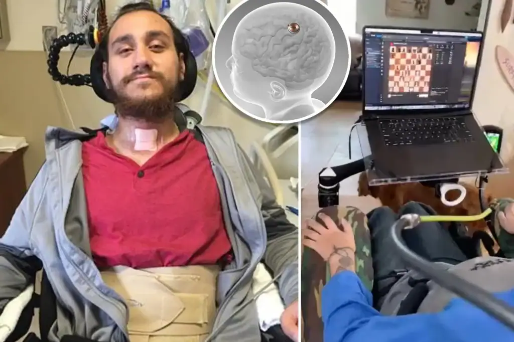 Homem que recebeu chip da neuralink joga civilization por comandos do cérebro; assista Noland arbaugh, homem que recebeu o chip cerebral da neuralink.