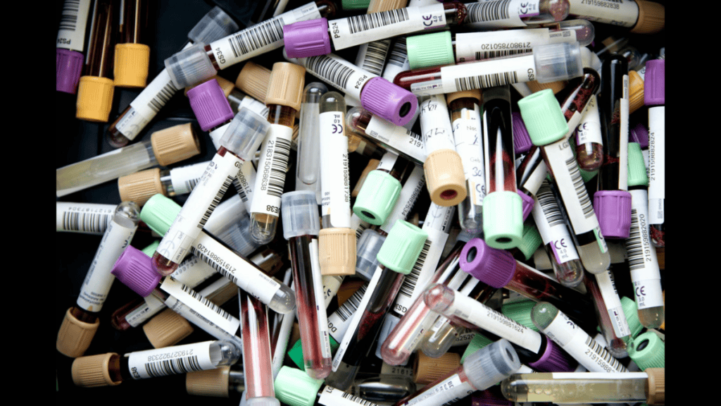 Doping-Olympiade fordert traditionelle Veranstaltung heraus, indem den Sportlern Steroide verabreicht werden 44 % der olympischen Athleten geben bereits zu, verbotene Substanzen konsumiert zu haben