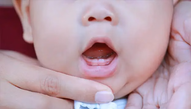 Un fármaco que hace que los dientes crezcan de forma natural ya tiene fecha para ser probado en humanos Un fármaco que hace que los dientes crezcan de forma natural ya tiene fecha para ser probado en humanos. Con un desarrollo prometedor desde julio de 2023, las primeras pruebas del fármaco en animales tuvieron éxito. Los ensayos en humanos comienzan a finales de este año.