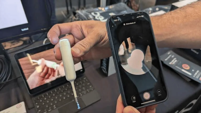 Veja os melhores produtos da ifa 2024 O aparelho permite uma visualização do interior do ouvido para limpeza ou aplicação de medicamento. Imagem: pcmag