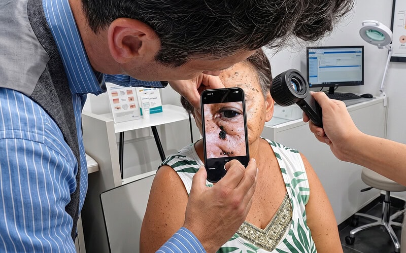 Startup brasileira usa inteligência artificial para agilizar a triagem de câncer de pele