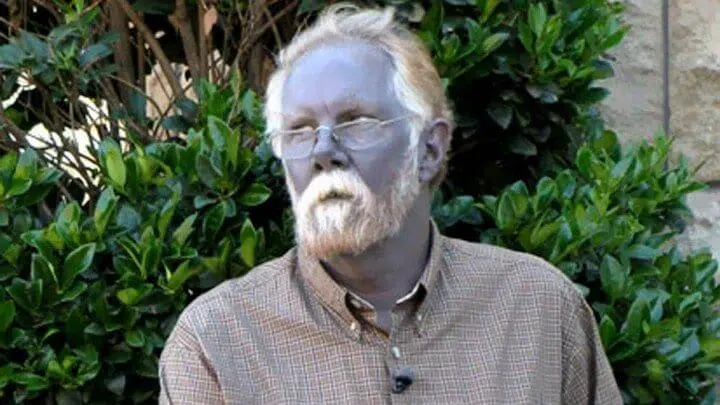 في المستقبل ، يجب أن يبدو الجنس البشري مثل ... البرازيليين! الناس الأزرق من كنتاكي الرجل الأزرق ميتهيموغلوبينية الدم