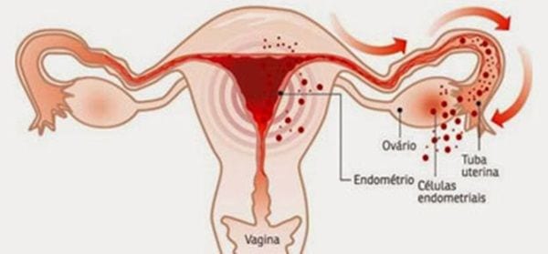 No mês das mulheres, a samsung ajuda no diagnóstico de doenças ginecológicas. A samsung oferece uma linha premium de aparelhos de ultrassom, dentre eles o ws80 elite, usado em exames de obstetrícia e ginecologia.